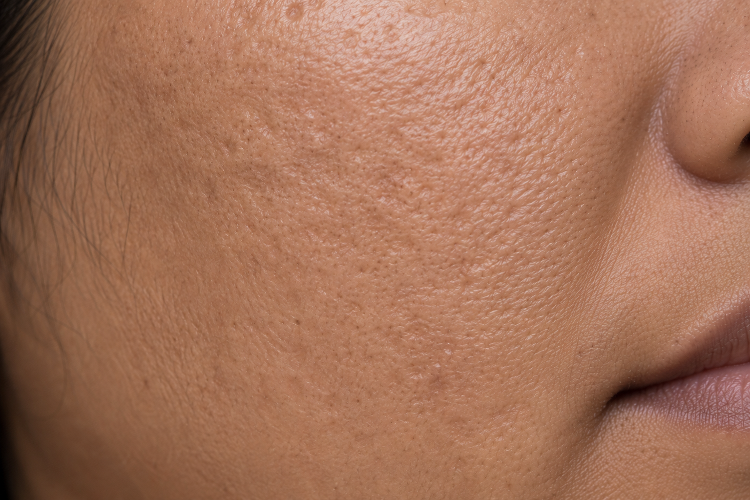 Uneven Texture